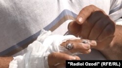 Житель Гиссара показывает язвы на руке