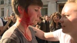 Наслідки масового побиття на мітингу в Москві – відео